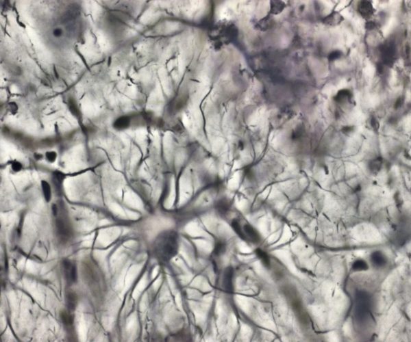 Preparación de Cajal Ilustración de un astrocito en el hipocampo, hacia 1890.