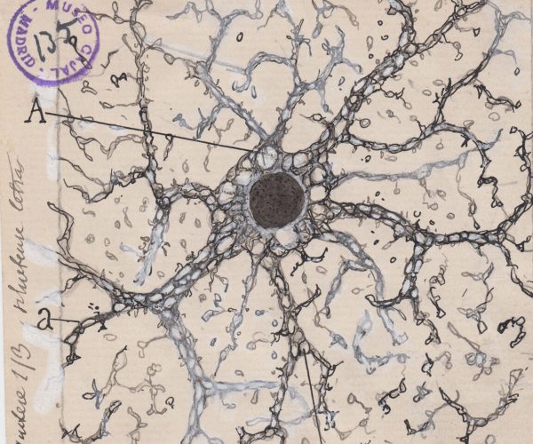 m135. Un astrocito en el hipocampo humano.