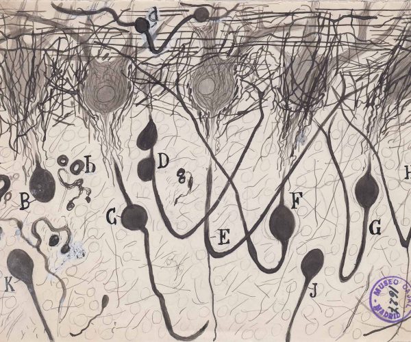 m1627. Axones de las neuronas de Purkinje en el cerebelo de un hombre ahogado.