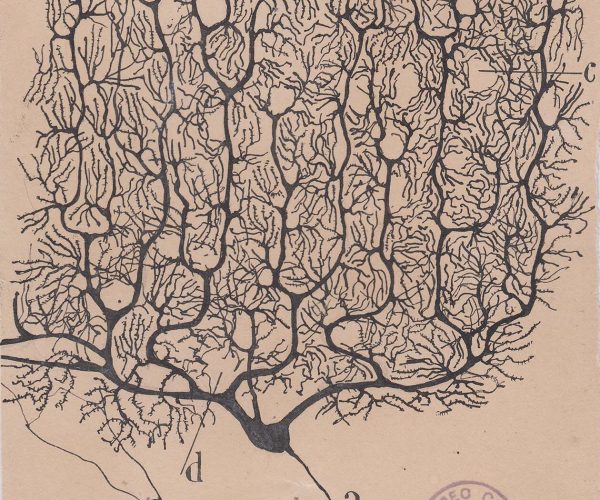 m328. Una neurona de Purkinje del cerebelo humano.