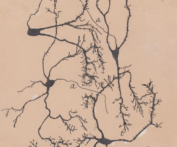 m567. Neuronas estrelladas en el cerebelo